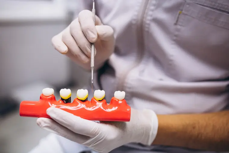 Trabajo de laboratorio sobre un modelo de dientes