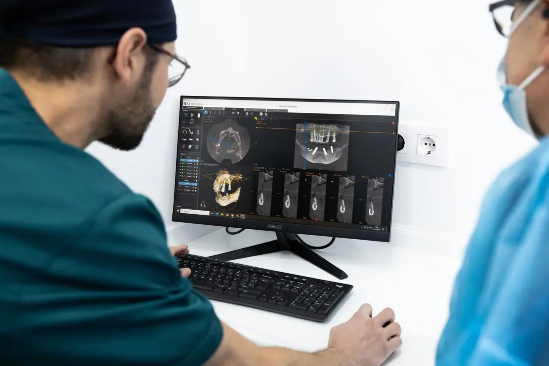 Dos odontólogos observan en un monitor la radiografía en 3D de un maxilar con implantes planificados